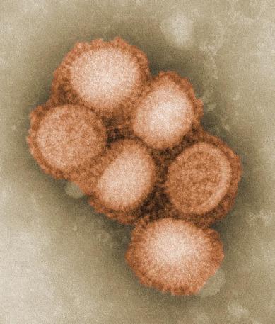 2009 H1N1 photo - Photo Credit - C. S. Goldsmith and A. Balish, CDC