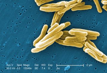 TB bacteria photo - Photo Credi -  Janice Carr, CDC