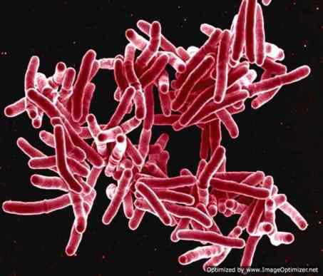 SEM photo of Mycobacterium tuberculosis bacteria. - Photo NIAD-Optimized